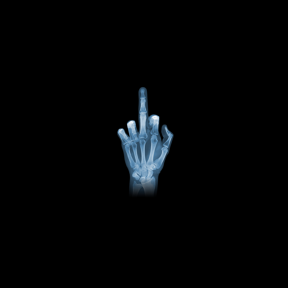 Röntgen Mittelfinger - Schwarzer-Kaffee