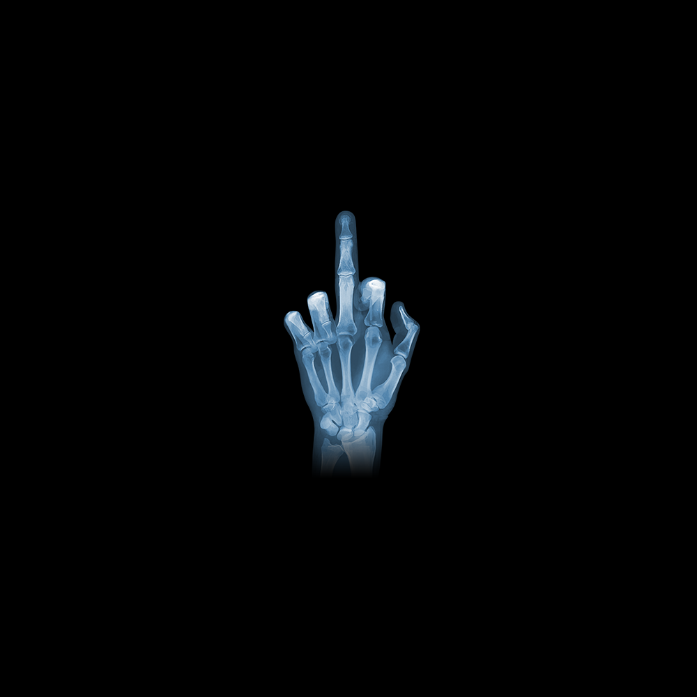 Röntgen Mittelfinger