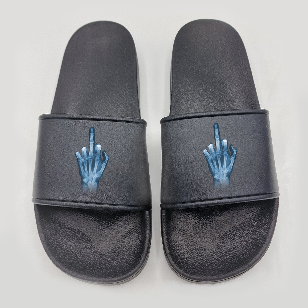 Badeschuhe Röntgen Mittelfinger